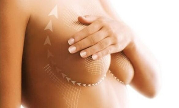Lift the sutures to enlarge the breast