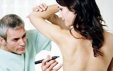 The surgical method of breast strengthening