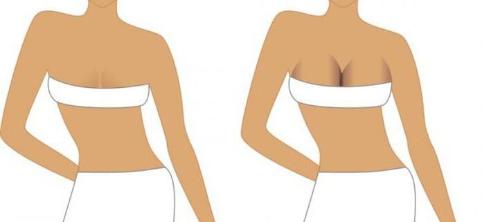 Postoperative period